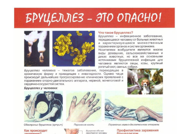 Памятка о профилактике бруцеллеза Памятка о профилактике бруцеллеза.